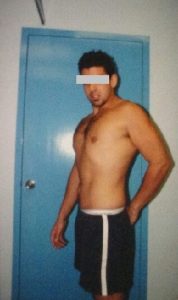 Weight Loss After Weight Loss After