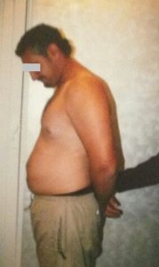 Weight Loss Before Weight Loss Before