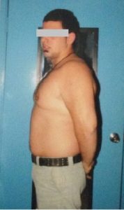 Weight Loss Before Weight Loss Before