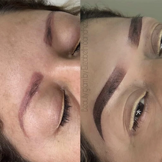 Brow Specialty