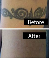 Client Transformation