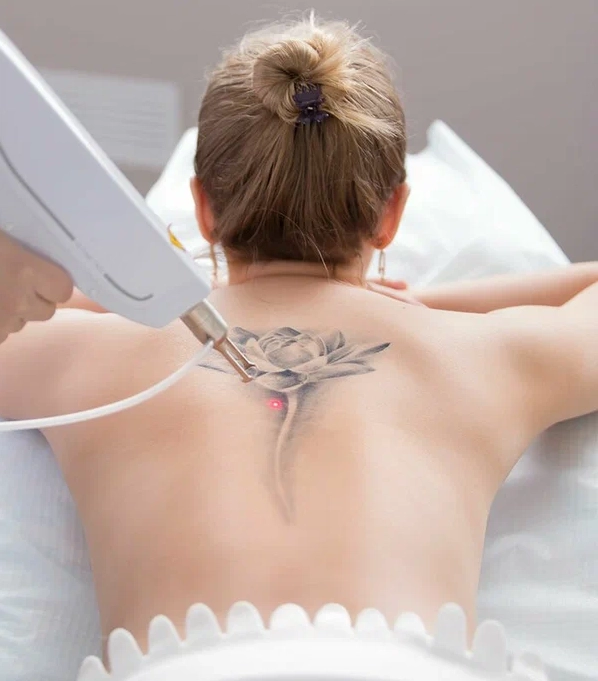 tattoo removal classes